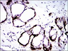 KRT5 / CK5 / Cytokeratin 5 Antibody - IHC of paraffin-embedded prostate tissues using CK5 mouse monoclonal antibody with DAB staining.
