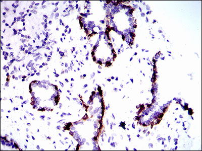 KRT5 / CK5 / Cytokeratin 5 Antibody - IHC of paraffin-embedded prostate tissues using CK5 mouse monoclonal antibody with DAB staining.