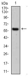 KRT5 / CK5 / Cytokeratin 5 Antibody - Western blot using CK5 mouse monoclonal antibody against A431 cell lysate.