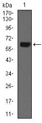 KRT5 / CK5 / Cytokeratin 5 Antibody - Cytokeratin 5 Antibody in Western Blot (WB)