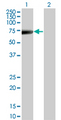 KRT5 / CK5 / Cytokeratin 5 Antibody - Western Blot analysis of KRT5 expression in transfected 293T cell line by KRT5 monoclonal antibody (M08), clone 1A12.Lane 1: KRT5 transfected lysate(62.4 KDa).Lane 2: Non-transfected lysate.
