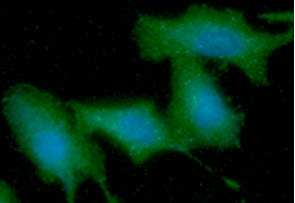 KRT5 / CK5 / Cytokeratin 5 Antibody - ICC/IF analysis of KRT5 in A549 cells line, stained with DAPI (Blue) for nucleus staining and monoclonal anti-human KRT5 antibody (1:100) with goat anti-mouse IgG-Alexa fluor 488 conjugate (Green).