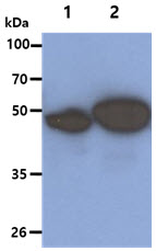 KRT5 / CK5 / Cytokeratin 5 Antibody - The Cell lysates (40ug) were resolved by SDS-PAGE, transferred to PVDF membrane and probed with anti-human KRT5 antibody (1:1000). Proteins were visualized using a goat anti-mouse secondary antibody conjugated to HRP and an ECL detection system. Lane 1. : HeLa cell lysate Lane 2. : A431 cell lysate