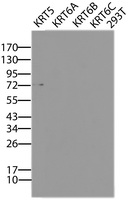 KRT5 / CK5 / Cytokeratin 5 Antibody - HEK293T cells were transfected with the pCMV6-ENTRY control (Lane 5) or pCMV6-ENTRY KRT5 (Lane 1), KRT6A (Lane 1), KRT6B (Lane 2), KRT6C (Lane 3) cDNA for 48 hrs and lysed. Equivalent amounts of cell lysates (5 ug per lane) were separated by SDS-PAGE and immunoblotted with anti-KRT5/6.