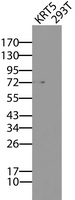 KRT5 / CK5 / Cytokeratin 5 Antibody - HEK293T cells were transfected with the pCMV6-ENTRY control (Right lane)or pCMV6-ENTRY KRT5 (left lane) cDNA for 48 hrs and lysed. Equivalent amounts of cell lysates (5 ug per lane) were separated by SDS-PAGE and immunoblotted with anti-KRT5/6.