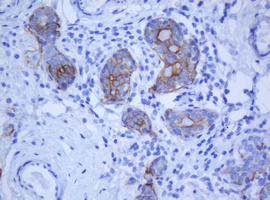 KRT5 / CK5 / Cytokeratin 5 Antibody - IHC of paraffin-embedded Human breast tissue using anti-KRT5 mouse monoclonal antibody.