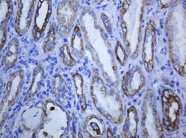 KRT5 / CK5 / Cytokeratin 5 Antibody - IHC of paraffin-embedded Human Kidney tissue using anti-KRT5 mouse monoclonal antibody.