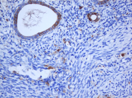 KRT5 / CK5 / Cytokeratin 5 Antibody - IHC of paraffin-embedded Human endometrium tissue using anti-KRT5 mouse monoclonal antibody.