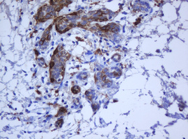 KRT5 / CK5 / Cytokeratin 5 Antibody - IHC of paraffin-embedded Human breast tissue using anti-KRT5 mouse monoclonal antibody.