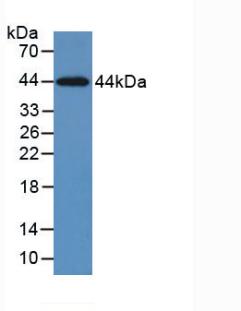 KRT5 / CK5 / Cytokeratin 5 Antibody - Western Blot; Sample: Recombinant KRT5, Human.