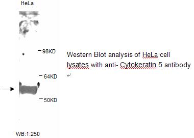 KRT5 / CK5 / Cytokeratin 5 Antibody