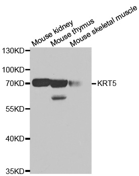 KRT5 / CK5 / Cytokeratin 5 Antibody - Western blot analysis of extracts of various cell lines.