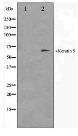 KRT5 / CK5 / Cytokeratin 5 Antibody - Western blot of HepG2 cell lysate using Keratin 5 Antibody