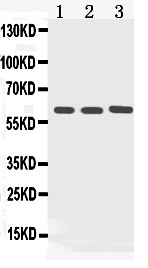 KRT5 / CK5 / Cytokeratin 5 Antibody - Western blot - Anti-Cytokeratin 5 Picoband Antibody