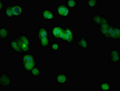 KRT5 / CK5 / Cytokeratin 5 Antibody - Immunofluorescent analysis of MCF-7 cells at a dilution of 1:100 and Alexa Fluor 488-congugated AffiniPure Goat Anti-Rabbit IgG(H+L)