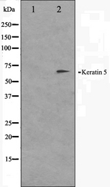 KRT5 / CK5 / Cytokeratin 5 Antibody - Western blot analysis on HepG2 cell lysates using Keratin 5 antibody. The lane on the left is treated with the antigen-specific peptide.
