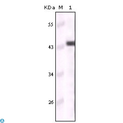 KRT5 / CK5 / Cytokeratin 5 Antibody - Immunohistochemistry (IHC) analysis of paraffin-embedded human esophagus epithelium (A), salivary gland basal cell (B), lung squamous cell carcinoma (C), endometrium admosquamous carcinoma (D), showing cytoplasmic and membrane localization with DAB staining usi.