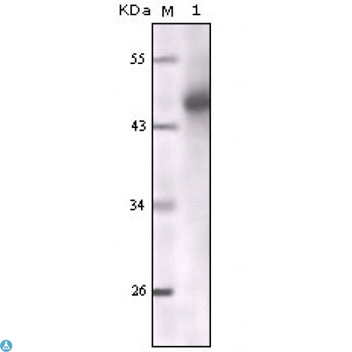 KRT5 / CK5 / Cytokeratin 5 Antibody - Immunofluorescence (IF) staining of methanol-fixed Eca-109 (left) and HepG2 (right) cells showing cytoplasmic localization using Cytokeratin (Pan) Monoclonal Antibody.