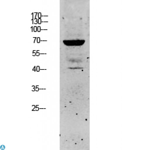 KRT5 / CK5 / Cytokeratin 5 Antibody - Western blot analysis of SW480 lysate, antibody was diluted at 1000. Secondary antibody was diluted at 1: 20000.
