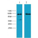 KRT6 / CK6 / Cytokeratin 6 Antibody - Western blot of Cytokeratin 6 antibody