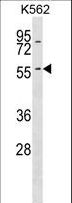 KRT6A / CK6A / Cytokeratin 6A Antibody - KRT6A Antibody western blot of K562 cell line lysates (35 ug/lane). The KRT6A antibody detected the KRT6A protein (arrow).