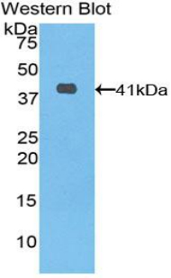 KRT6A / CK6A / Cytokeratin 6A Antibody - Western blot of recombinant KRT6A / Cytokeratin 6A.  This image was taken for the unconjugated form of this product. Other forms have not been tested.
