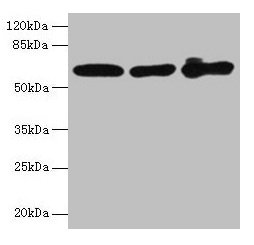 KRT6A / CK6A / Cytokeratin 6A Antibody - Western blot All lanes: Keratin, type II cytoskeletal 6A antibody at 4µg/ml Lane 1: A431 whole cell lysate Lane 2: K562 whole cell lysate Lane 3: MCF-7 whole cell lysate Secondary Goat polyclonal to rabbit IgG at 1/10000 dilution Predicted band size: 60 kDa Observed band size: 60 kDa
