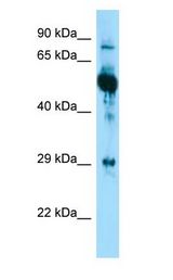 KRT6A / CK6A / Cytokeratin 6A Antibody - KRT6A / Cytokeratin 6A antibody Western Blot of A549.  This image was taken for the unconjugated form of this product. Other forms have not been tested.