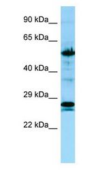 KRT6A / CK6A / Cytokeratin 6A Antibody - KRT6A / Cytokeratin 6A antibody Western Blot of MCF7.  This image was taken for the unconjugated form of this product. Other forms have not been tested.
