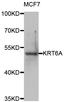 KRT6A / CK6A / Cytokeratin 6A Antibody - Western blot analysis of extracts of MCF7 cells.