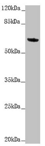 KRT6A / CK6A / Cytokeratin 6A Antibody - Western blot All Lanes:KRT6A antibody at 5.06 ug/ml +Mouse lung tissue Secondary Goat polyclonal to rabbit IgG at 1/10000 dilution Predicted band size: 60 kDa Observed band size: 60 kDa