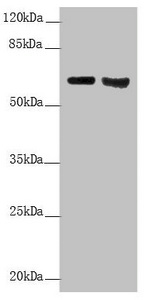 KRT6A / CK6A / Cytokeratin 6A Antibody - Western blot All Lanes: KRT6A antibody at 5.82 ug/ml Lane 1: Mouse lung tissue Lane 2: A431 whole cell lysate Secondary Goat polyclonal to rabbit IgG at 1/10000 dilution Predicted band size: 60 kDa Observed band size: 60 kDa