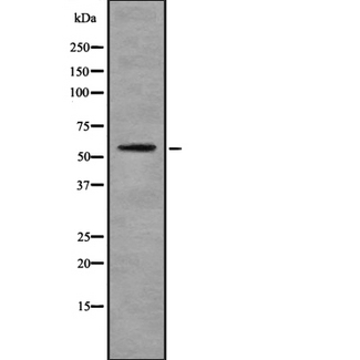 KRT6A / CK6A / Cytokeratin 6A Antibody - Western blot analysis of KRT6A using HuvEc whole lysates.