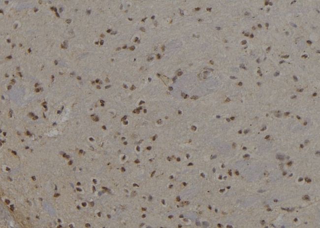 KRT6A / CK6A / Cytokeratin 6A Antibody - 1:100 staining rat brain tissue by IHC-P. The sample was formaldehyde fixed and a heat mediated antigen retrieval step in citrate buffer was performed. The sample was then blocked and incubated with the antibody for 1.5 hours at 22°C. An HRP conjugated goat anti-rabbit antibody was used as the secondary.