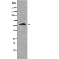 KRT6A / CK6A / Cytokeratin 6A Antibody - Western blot analysis of K2C6B using MCF-7 whole cells lysates