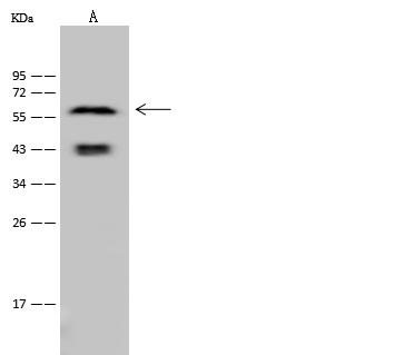 KRT6A / CK6A / Cytokeratin 6A Antibody - Anti-KRT6A rabbit polyclonal antibody at 1:500 dilution. Lane A: A431 Whole Cell Lysate. Lysates/proteins at 30 ug per lane. Secondary: Goat Anti-Rabbit IgG (H+L)/HRP at 1/10000 dilution. Developed using the ECL technique. Performed under reducing conditions. Predicted band size: 60 kDa. Observed band size: 60 kDa.