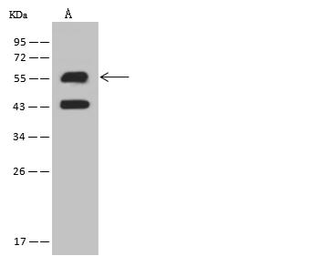 KRT6A / CK6A / Cytokeratin 6A Antibody - Anti-KRT6A rabbit polyclonal antibody at 1:10000 dilution. Lane A: A431 Whole Cell Lysate. Lysates/proteins at 30 ug per lane. Secondary: Goat Anti-Rabbit IgG (H+L)/HRP at 1/10000 dilution. Developed using the ECL technique. Performed under reducing conditions. Predicted band size: 60 kDa. Observed band size: 60 kDa. (We are unsure as to the identity of these extra bands.)
