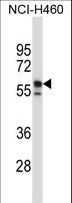 KRT6B / CK6B / Cytokeratin 6B Antibody - KRT6B Antibody western blot of NCI-H460 cell line lysates (35 ug/lane). The KRT6B antibody detected the KRT6B protein (arrow).