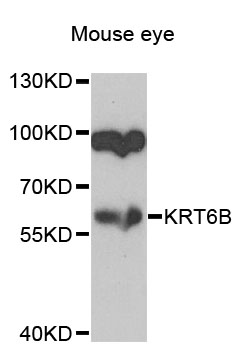 KRT6B / CK6B / Cytokeratin 6B Antibody - Western blot analysis of extracts of mouse eye cells.