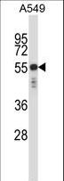 KRT6C / CK6C / Cytokeratin 6C Antibody - KRT6C Antibody western blot of A549 cell line lysates (35 ug/lane). The KRT6C antibody detected the KRT6C protein (arrow).