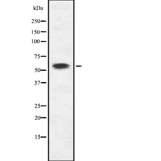 KRT6C / CK6C / Cytokeratin 6C Antibody - Western blot analysis of K2C6B/C expression in HEK293 cells. The lane on the left is treated with the antigen-specific peptide.