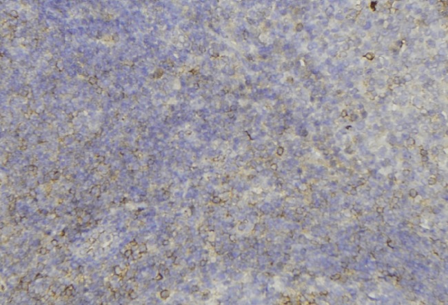 KRT6C / CK6C / Cytokeratin 6C Antibody - 1:100 staining human lymph node tissue by IHC-P. The sample was formaldehyde fixed and a heat mediated antigen retrieval step in citrate buffer was performed. The sample was then blocked and incubated with the antibody for 1.5 hours at 22°C. An HRP conjugated goat anti-rabbit antibody was used as the secondary.