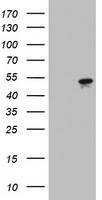 KRT7 / CK7 / Cytokeratin 7 Antibody - HEK293T cells were transfected with the pCMV6-ENTRY control (Left lane) or pCMV6-ENTRY KRT7 (Right lane) cDNA for 48 hrs and lysed. Equivalent amounts of cell lysates (5 ug per lane) were separated by SDS-PAGE and immunoblotted with anti-KRT7.