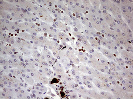 KRT7 / CK7 / Cytokeratin 7 Antibody - IHC of paraffin-embedded Human liver tissue using anti-KRT7 mouse monoclonal antibody. (Heat-induced epitope retrieval by 10mM citric buffer, pH6.0, 120°C for 3min).