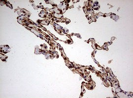 KRT7 / CK7 / Cytokeratin 7 Antibody - IHC of paraffin-embedded Human lung tissue using anti-KRT7 mouse monoclonal antibody. (Heat-induced epitope retrieval by 10mM citric buffer, pH6.0, 120°C for 3min).