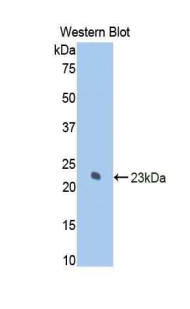 KRT7 / CK7 / Cytokeratin 7 Antibody - Western blot of recombinant KRT7 / CK7 / Cytokeratin 7.  This image was taken for the unconjugated form of this product. Other forms have not been tested.
