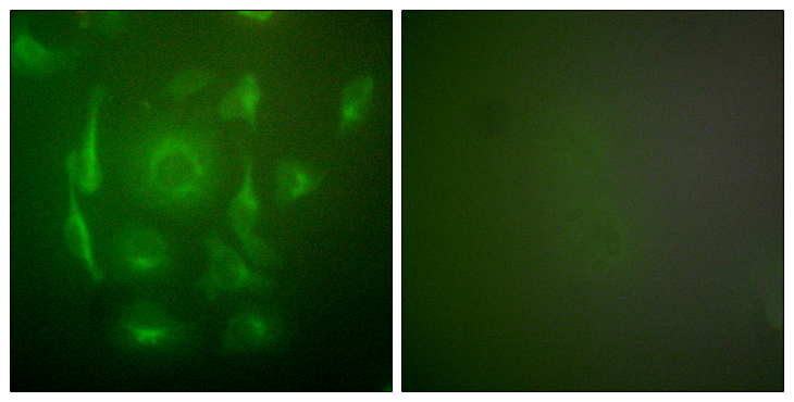 KRT7 / CK7 / Cytokeratin 7 Antibody - Immunofluorescence analysis of HepG2 cells, using Keratin 7 Antibody. The picture on the right is blocked with the synthesized peptide.