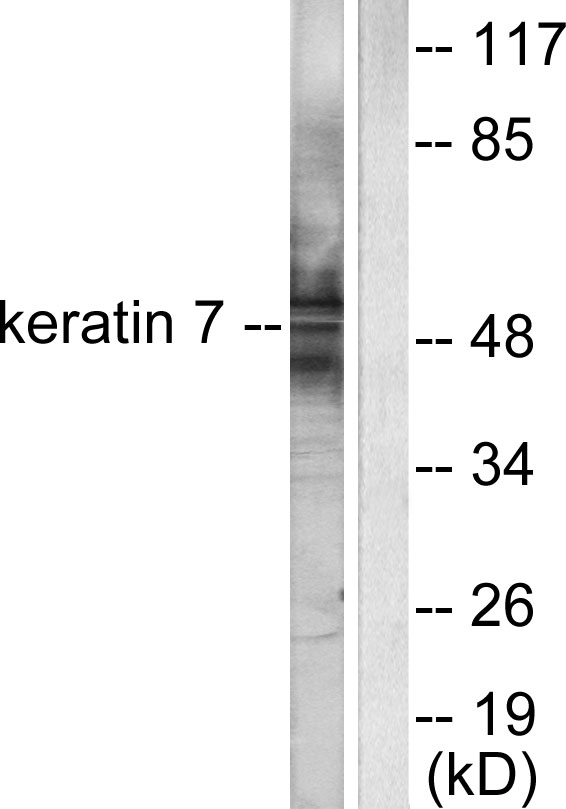 KRT7 / CK7 / Cytokeratin 7 Antibody - Western blot analysis of lysates from HepG2 cells, using Keratin 7 Antibody. The lane on the right is blocked with the synthesized peptide.