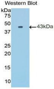 KRT7 / CK7 / Cytokeratin 7 Antibody - Western blot of recombinant KRT7 / CK7 / Cytokeratin 7.  This image was taken for the unconjugated form of this product. Other forms have not been tested.