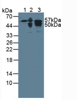KRT7 / CK7 / Cytokeratin 7 Antibody - Western Blot; Sample: Lane1: Human Lung Tissue; Lane2: Human Saliva; Lane3: Human HepG2 Cells.
